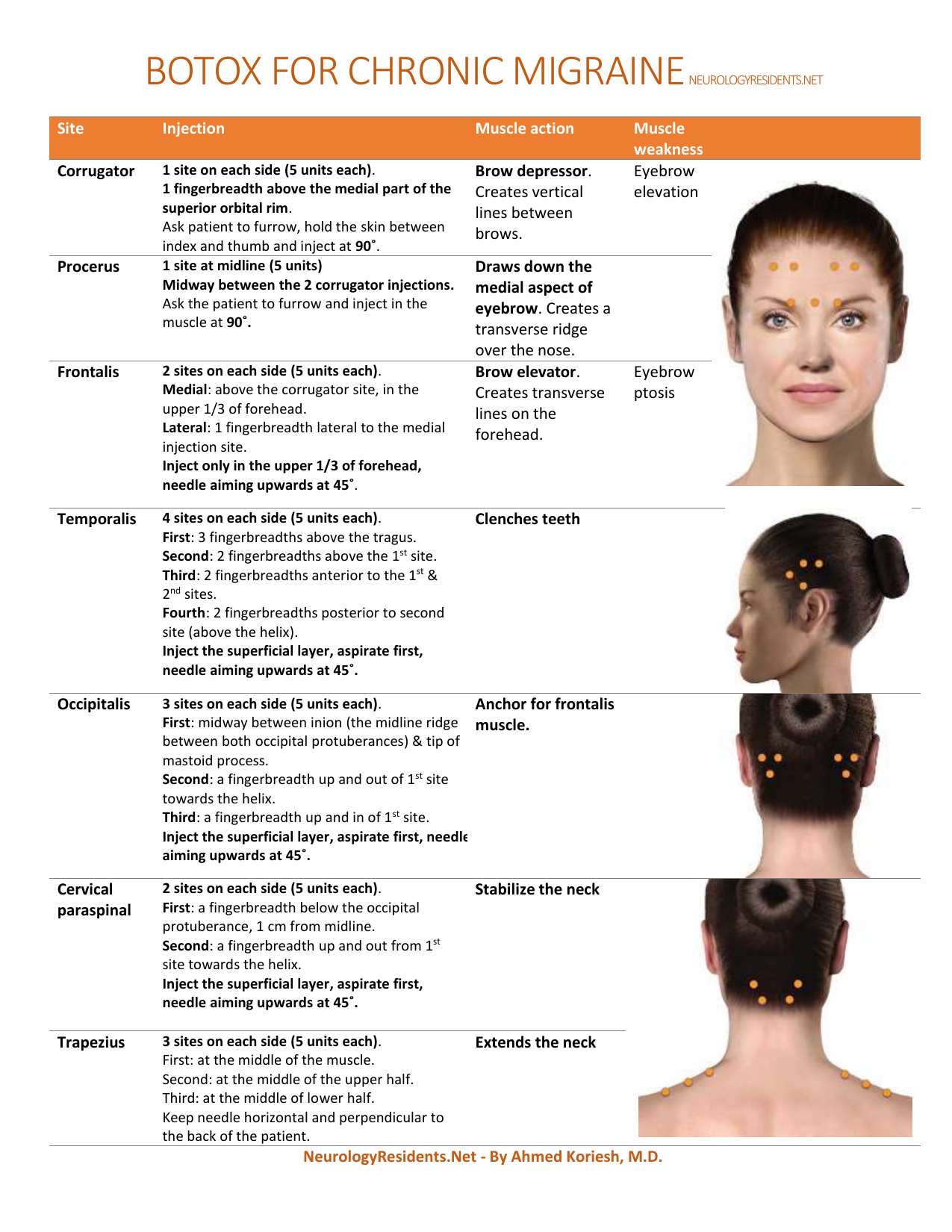 Botox Injection Sites Poster